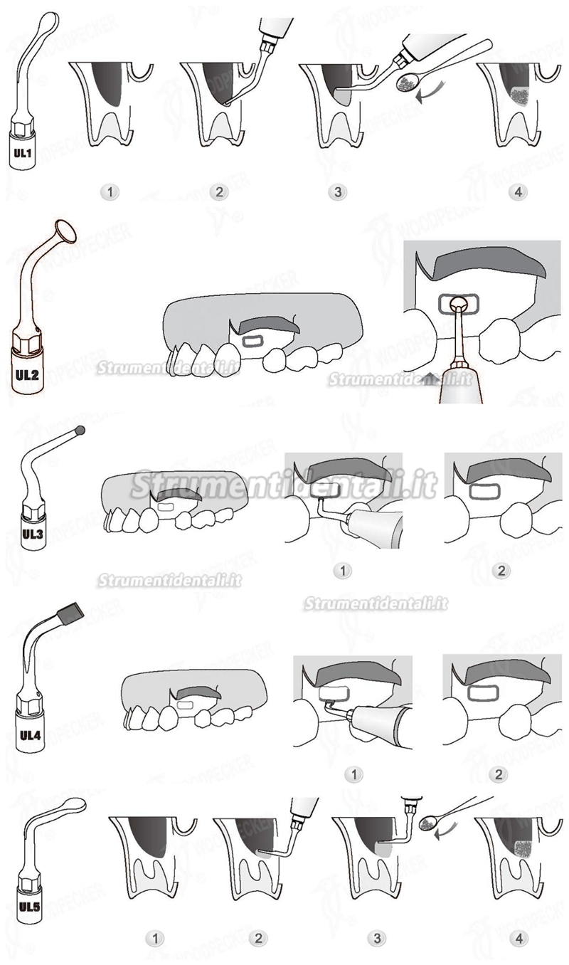 Woodpecker® Inserti Pizeo Sinus Ascensore Chirurgia Kit